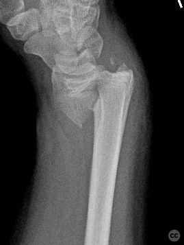 case image