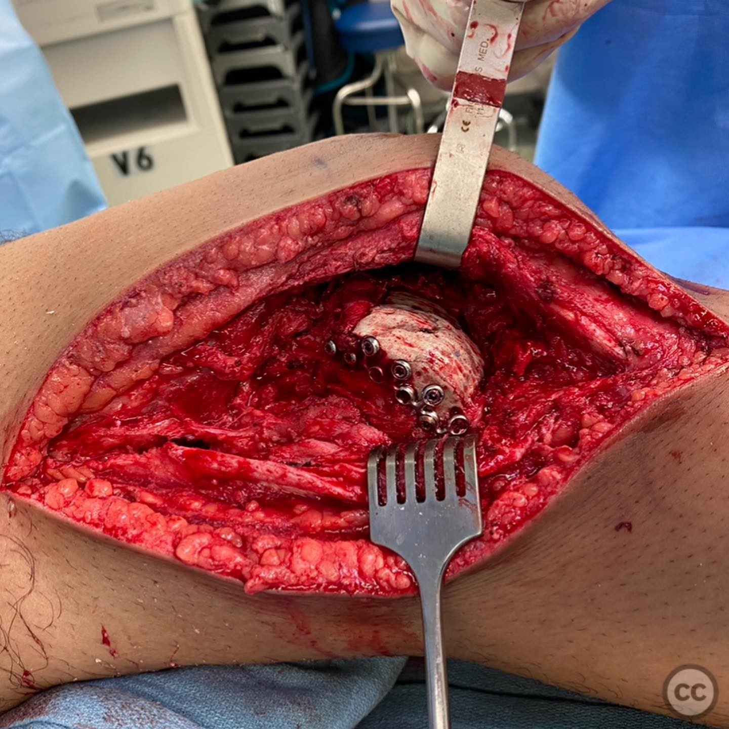 case image