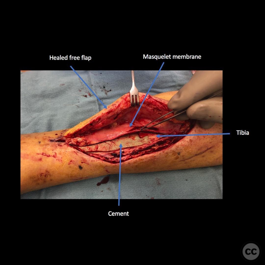 case image