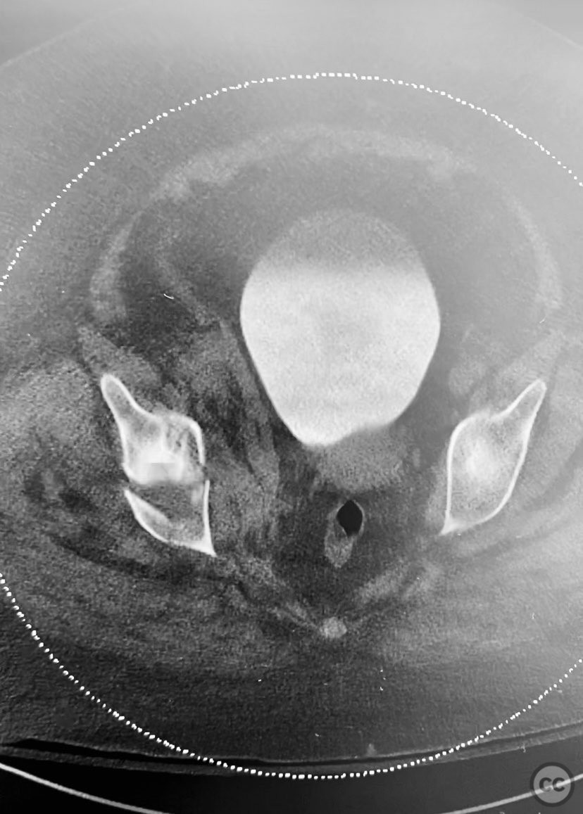 case image