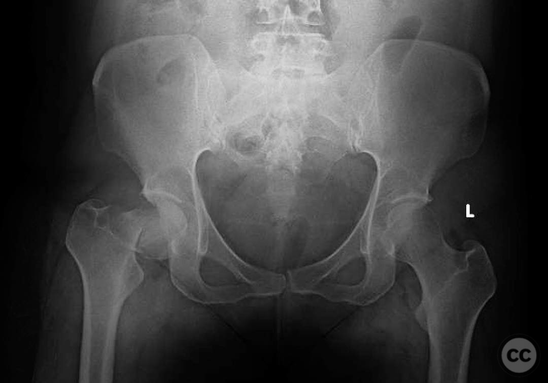 case image