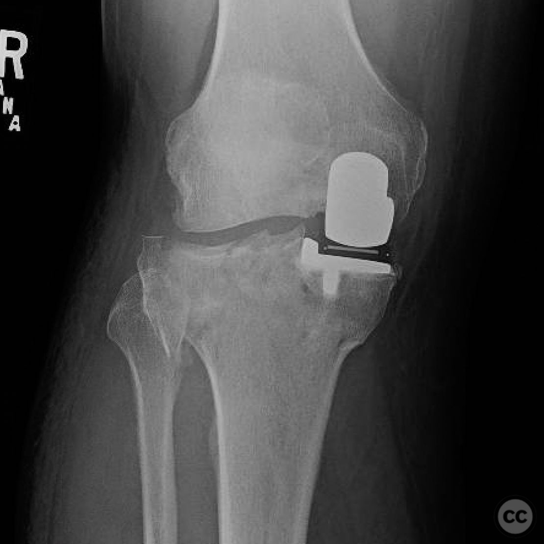 case image