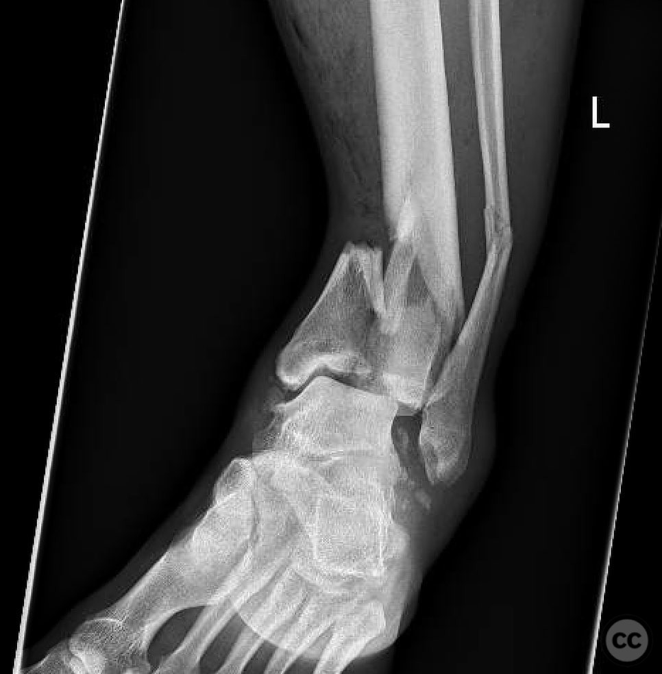 case image