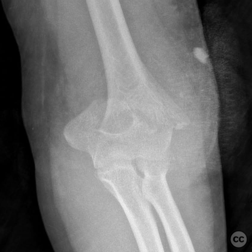 case image