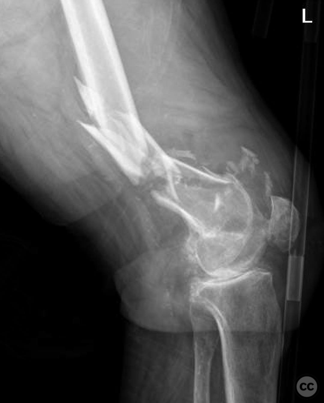 case image