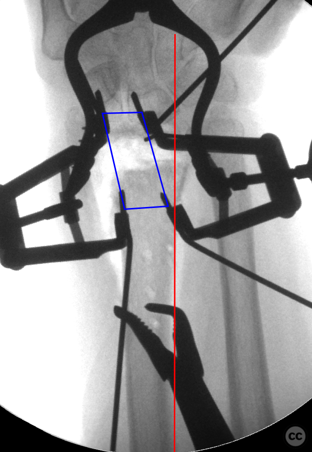 case image