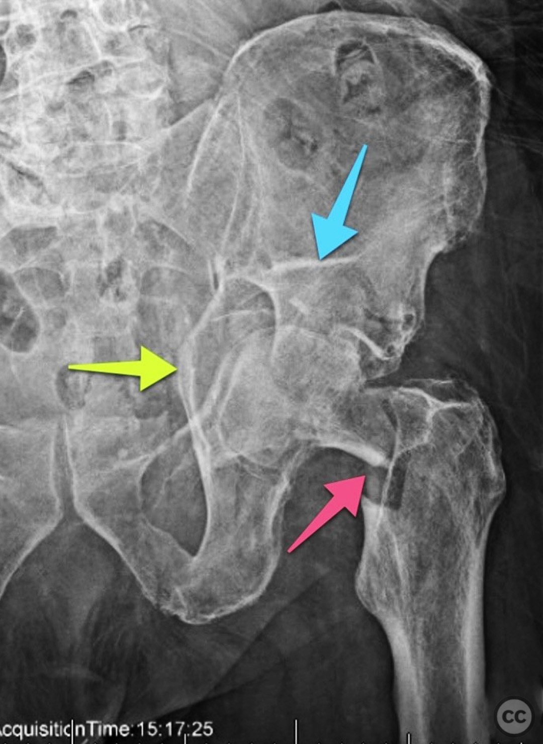 case image