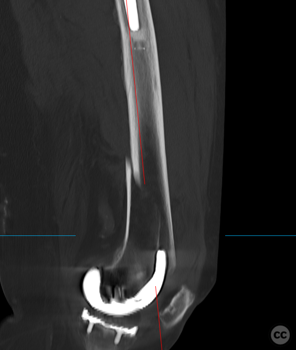 case image