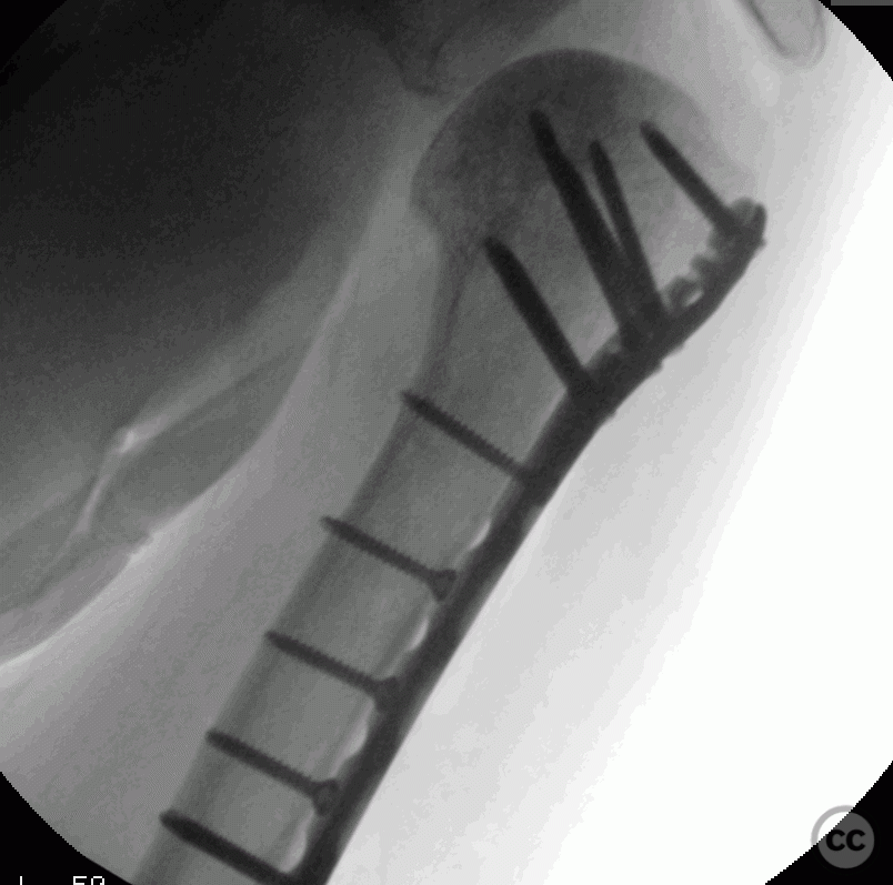 case image