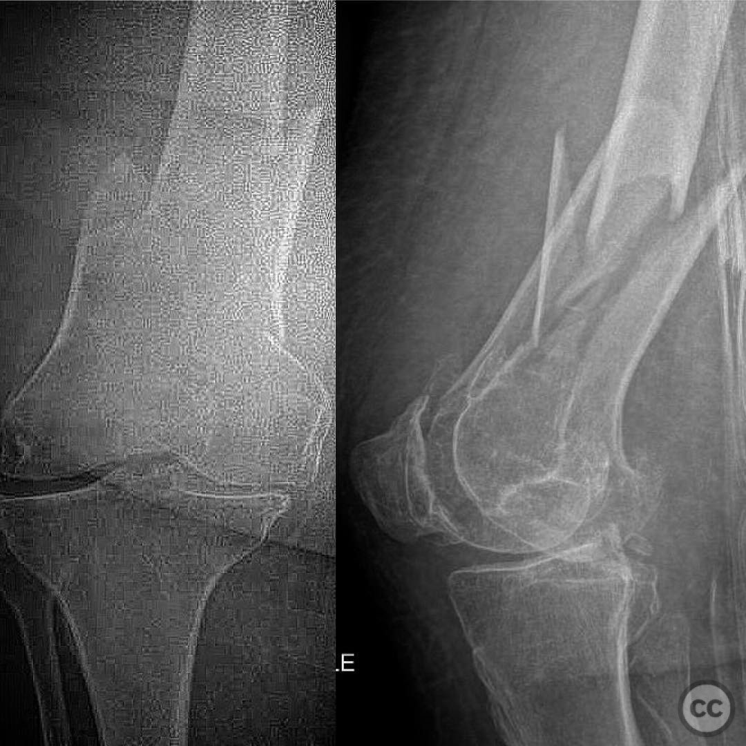 case image