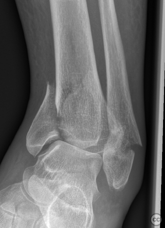 case image