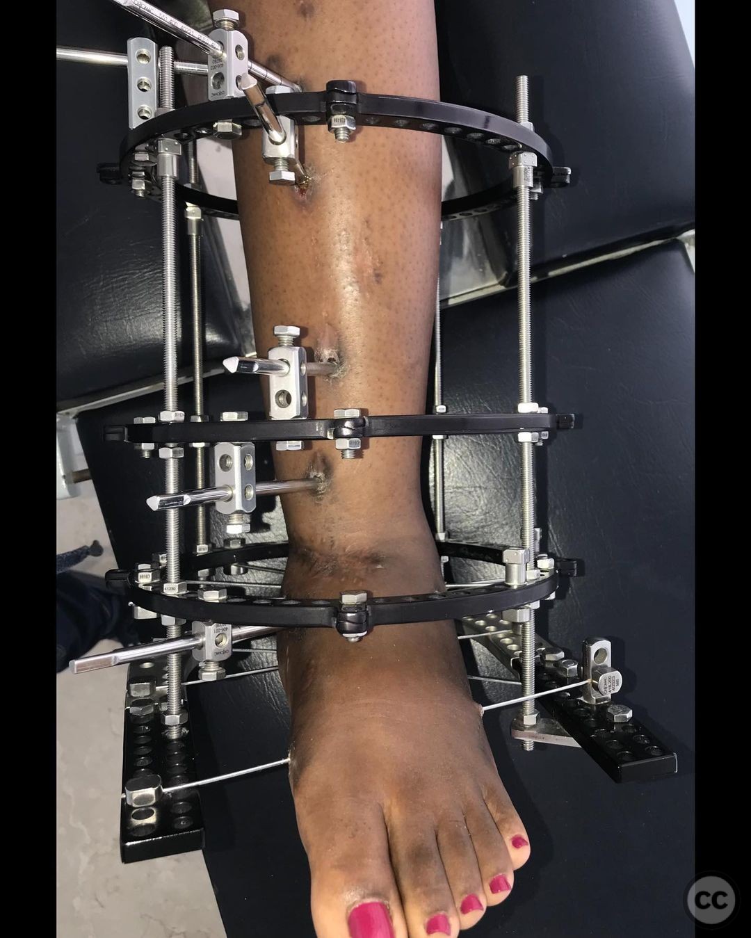 case image