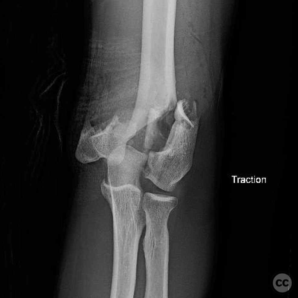 case image