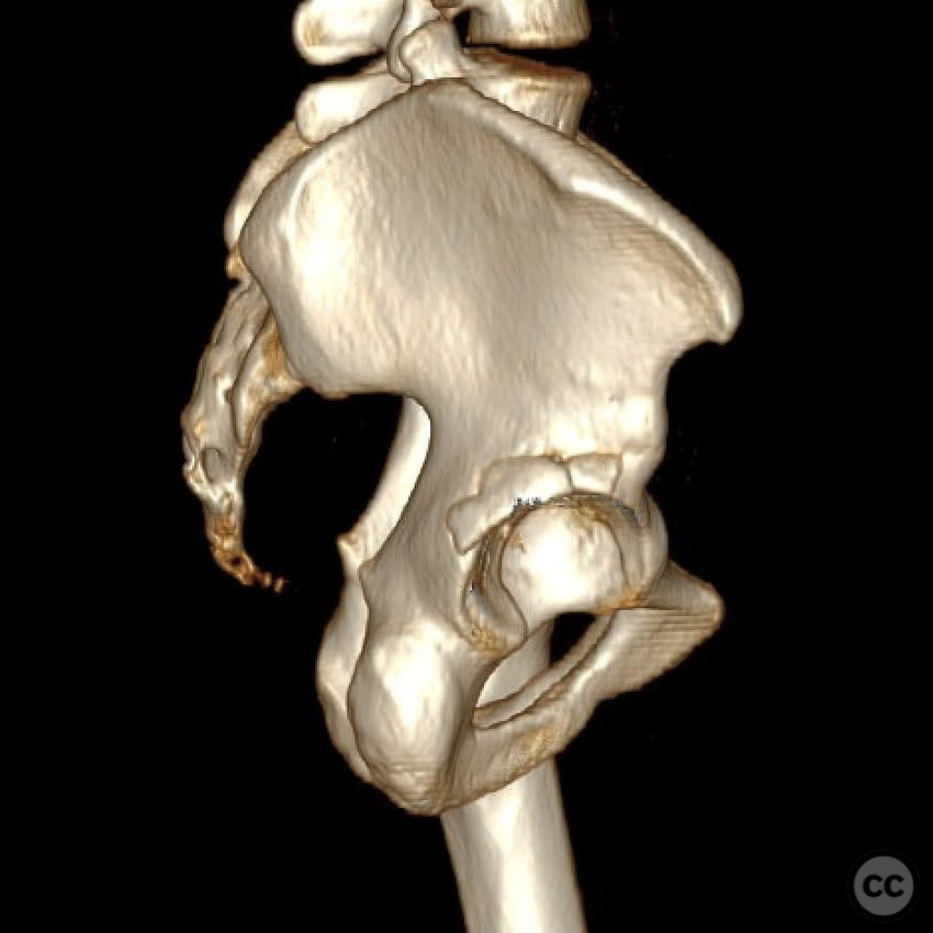 case image