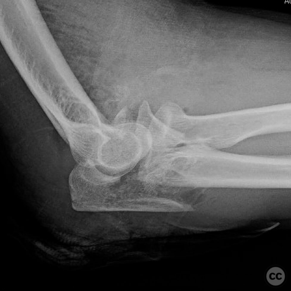 case image