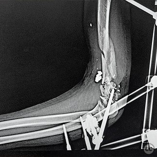 case image