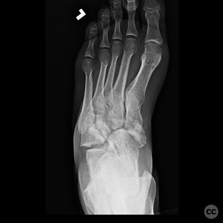case image