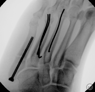 case image