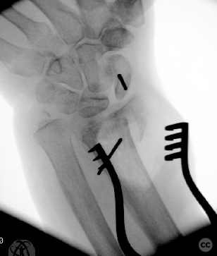 case image