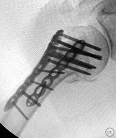case image