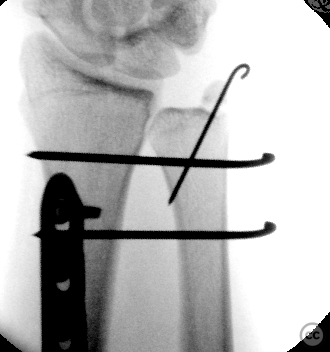 case image