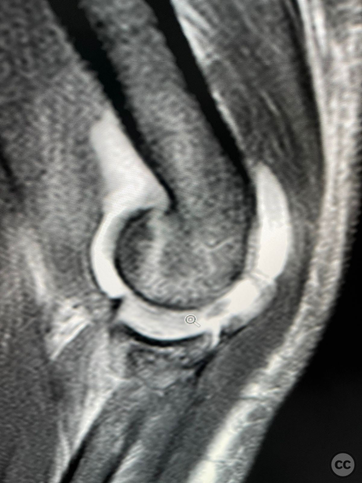 case image
