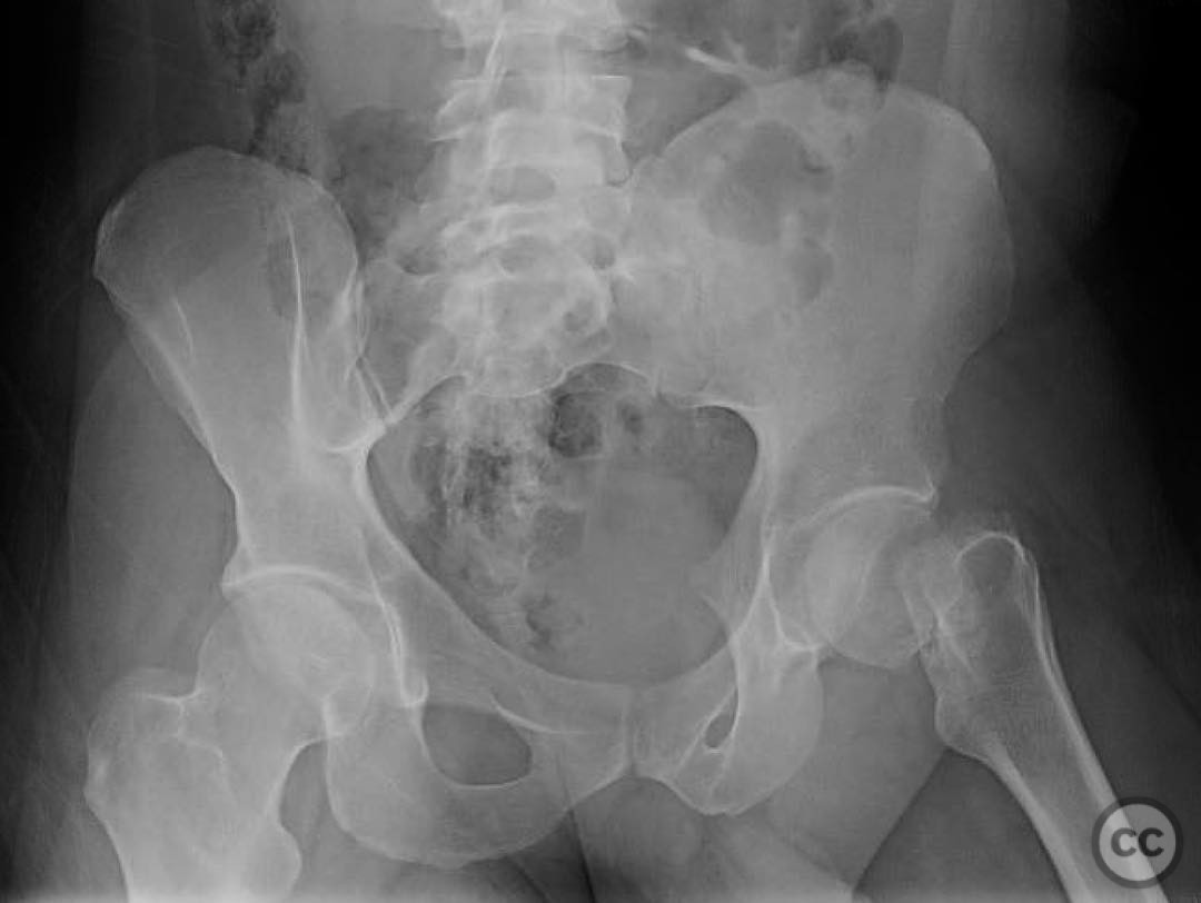 case image