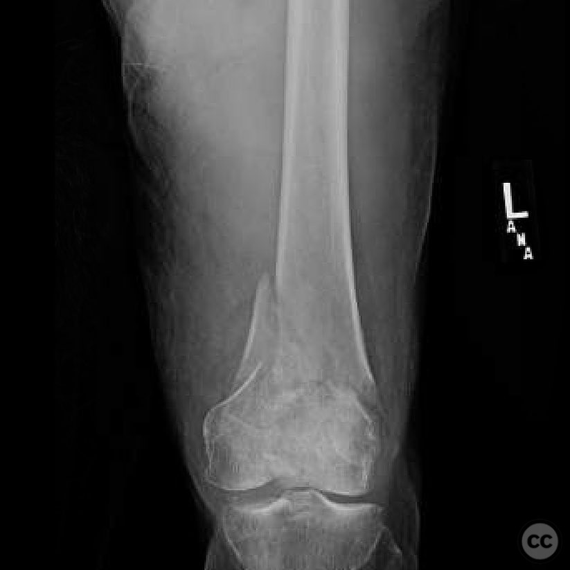case image