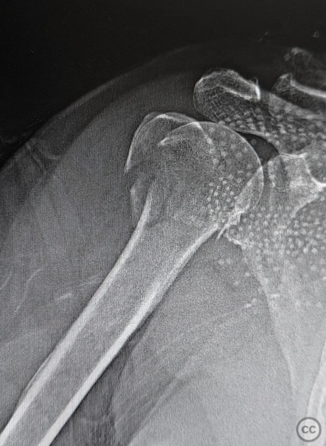 case image