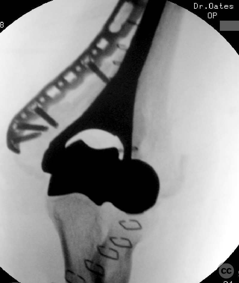 case image