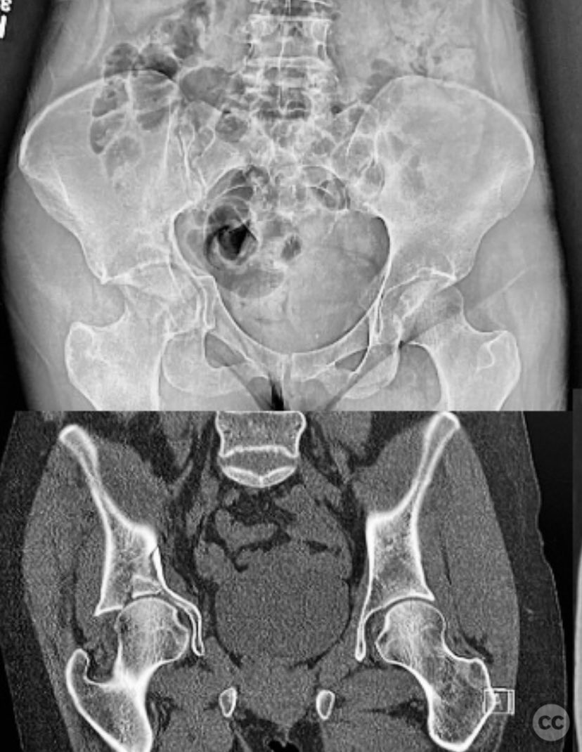 case image