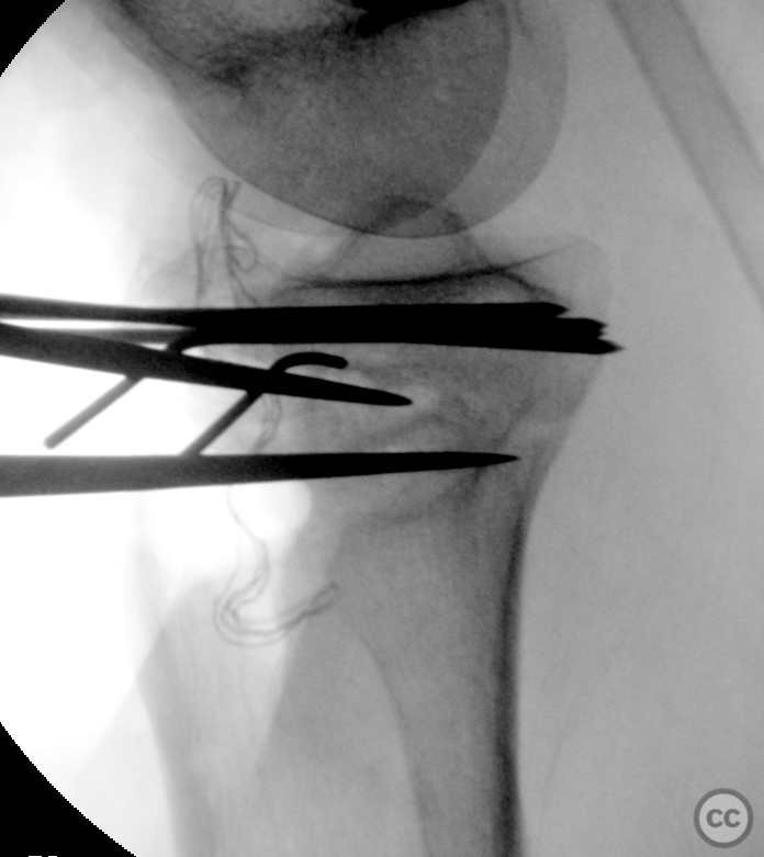 case image