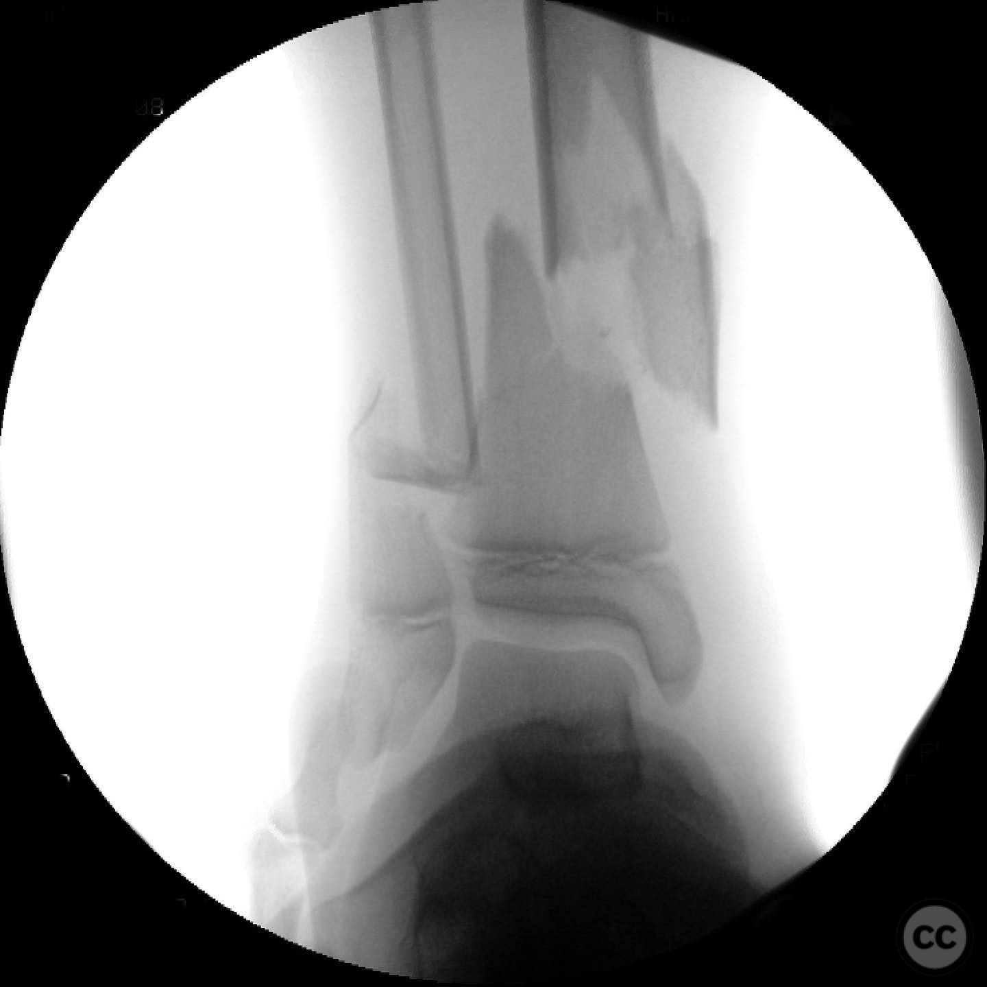 case image