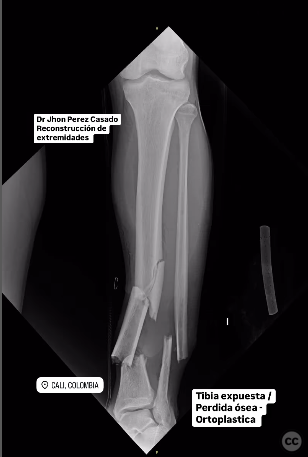 case image