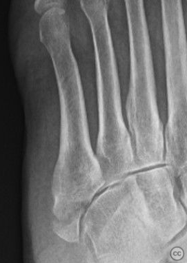 case image