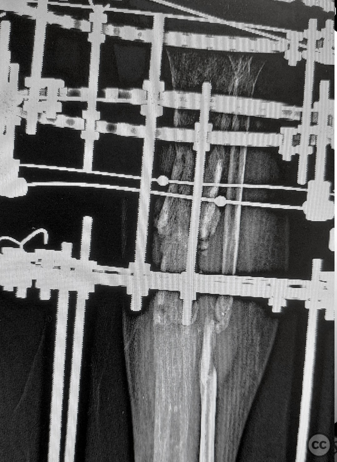 case image