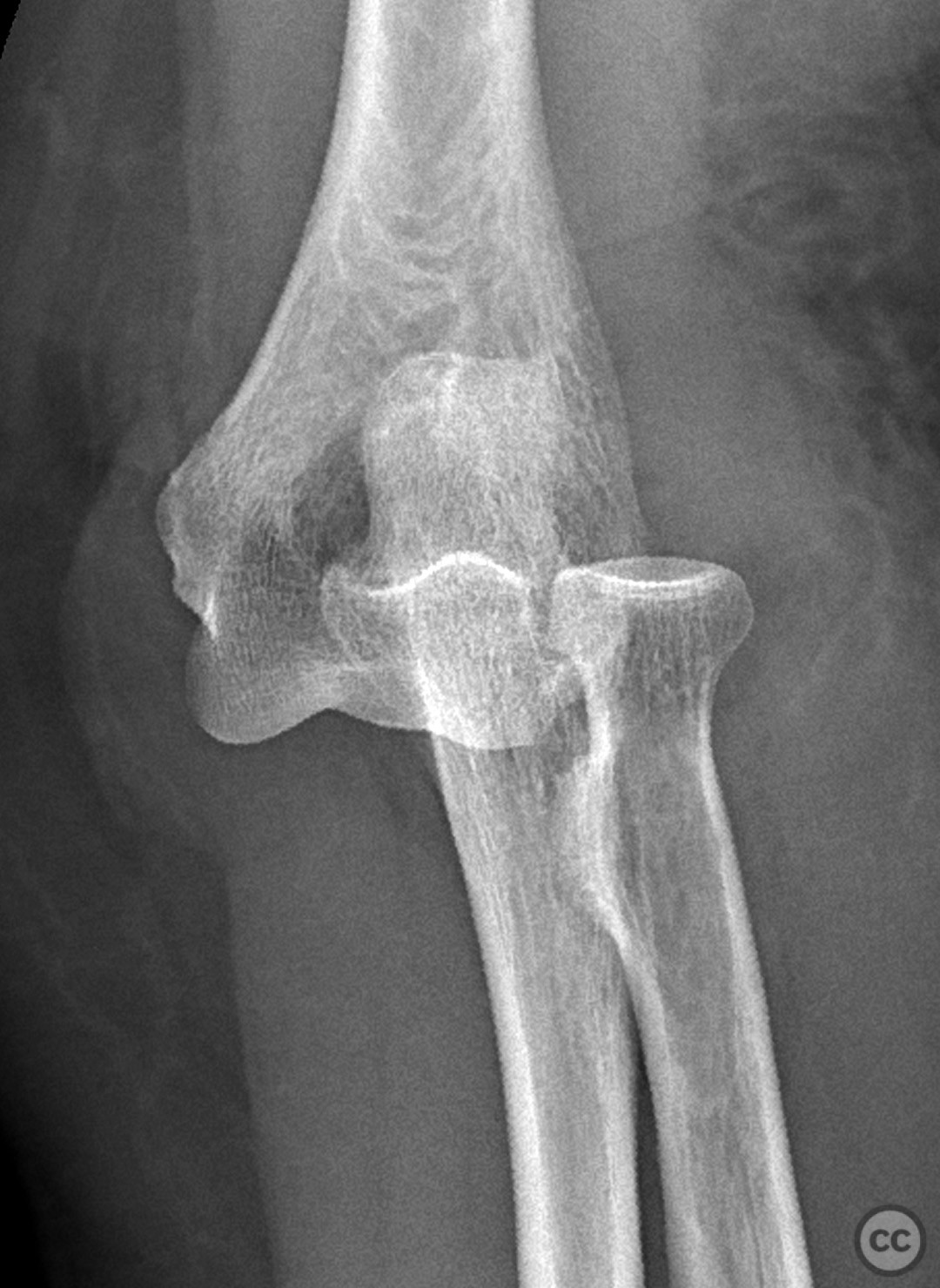 case image