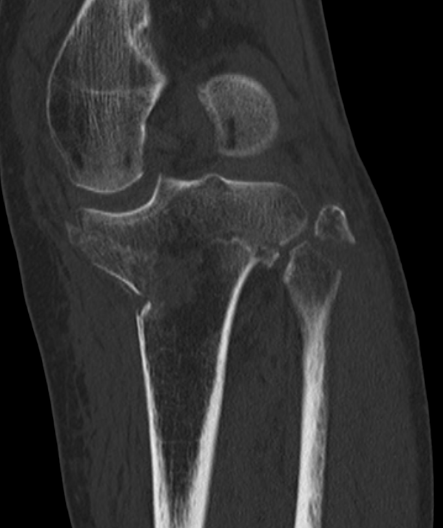 case image