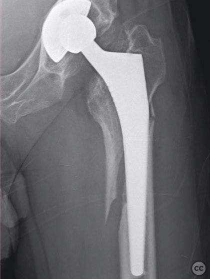 case image