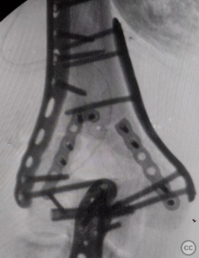 case image