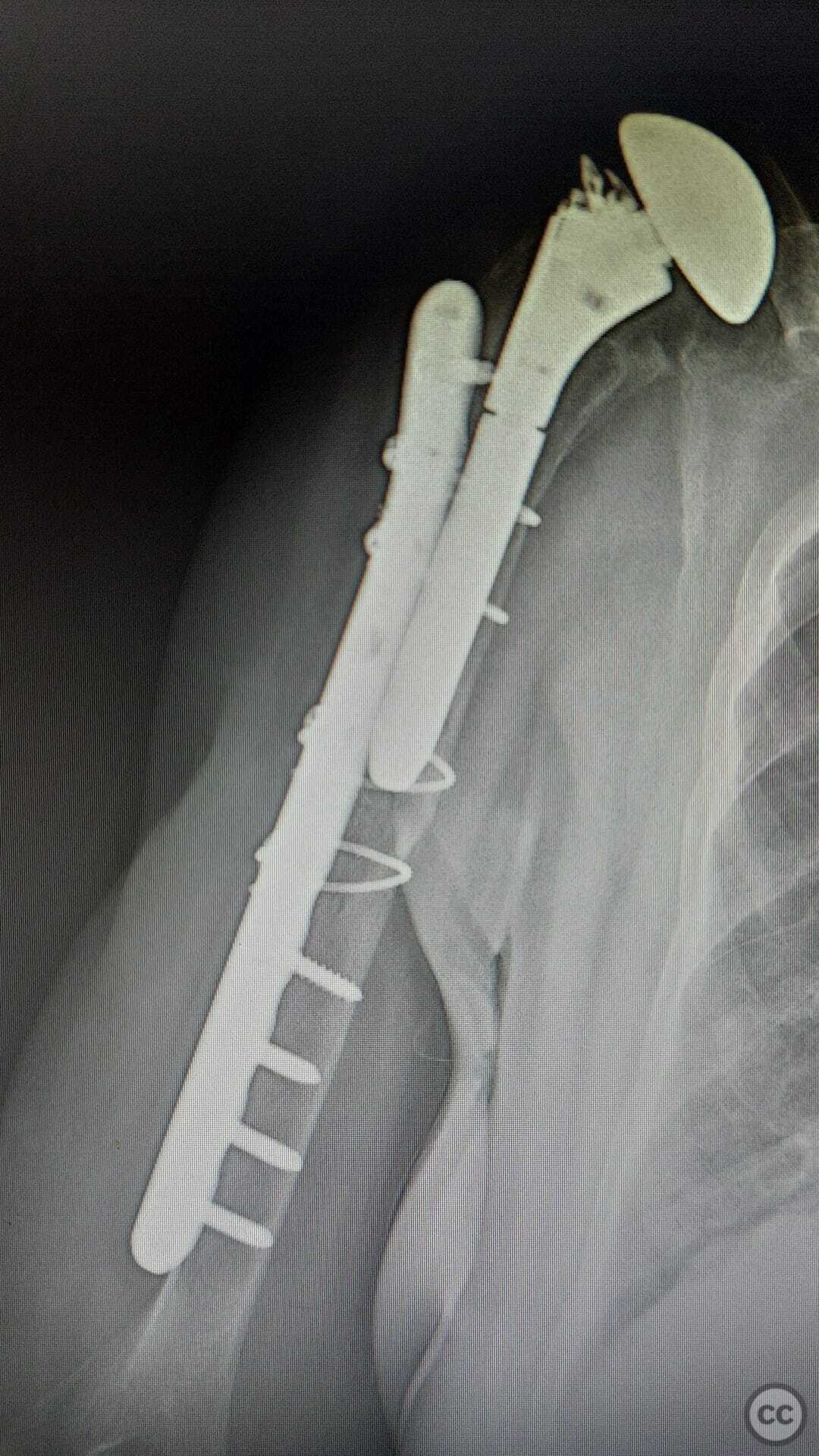 case image