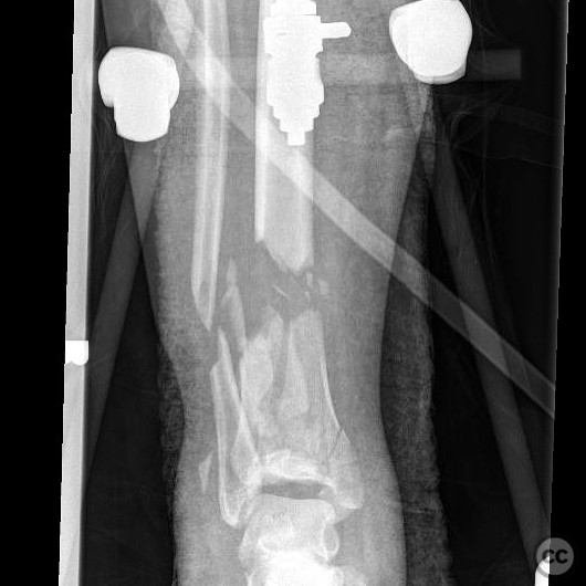 case image
