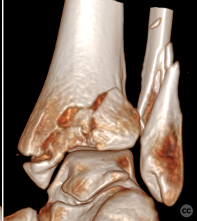 case image