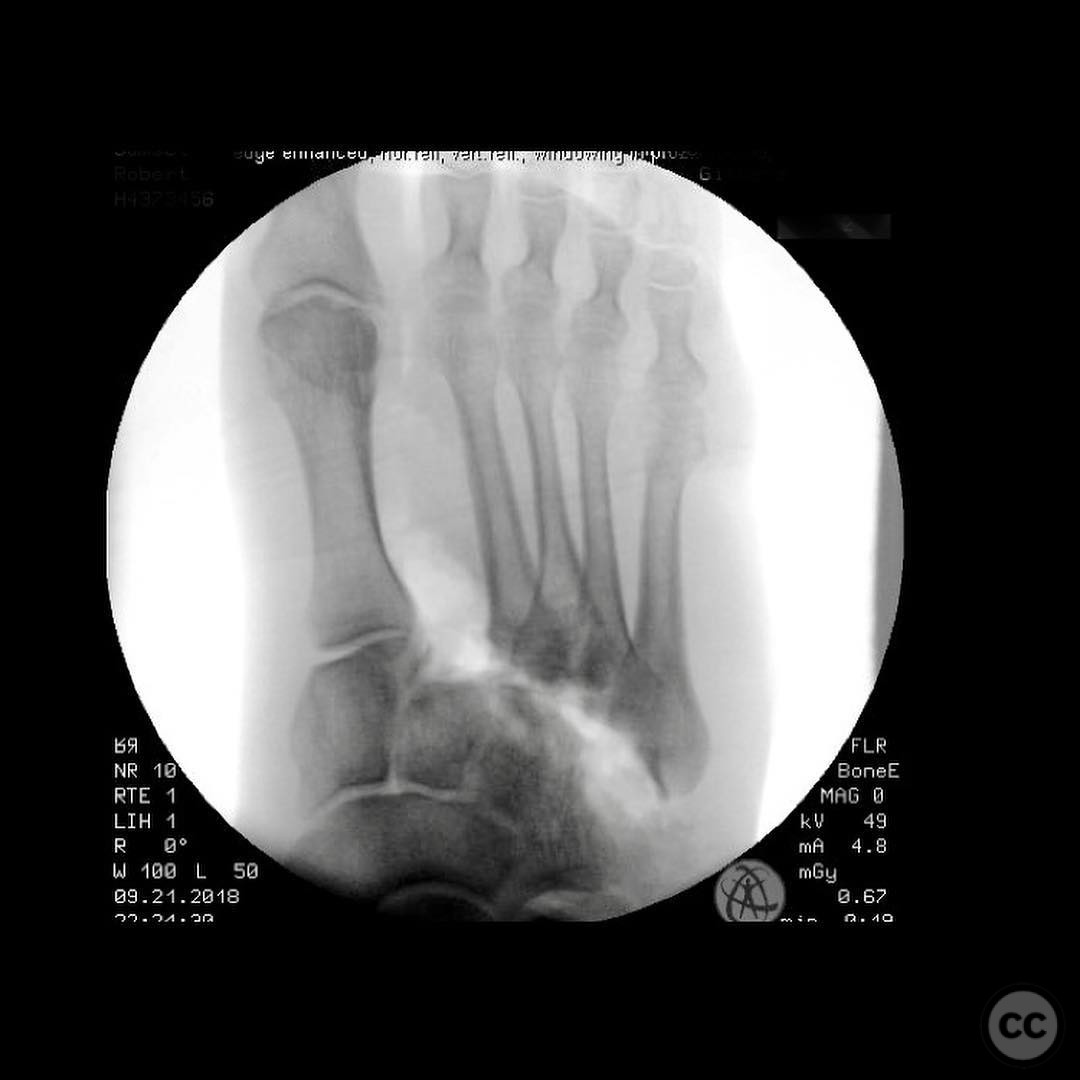 case image