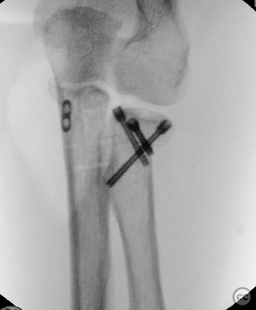 case image
