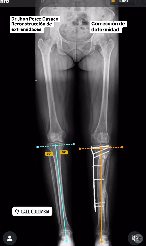 case image