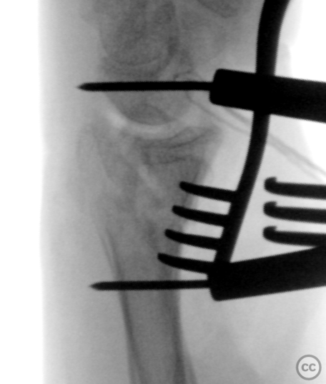 case image
