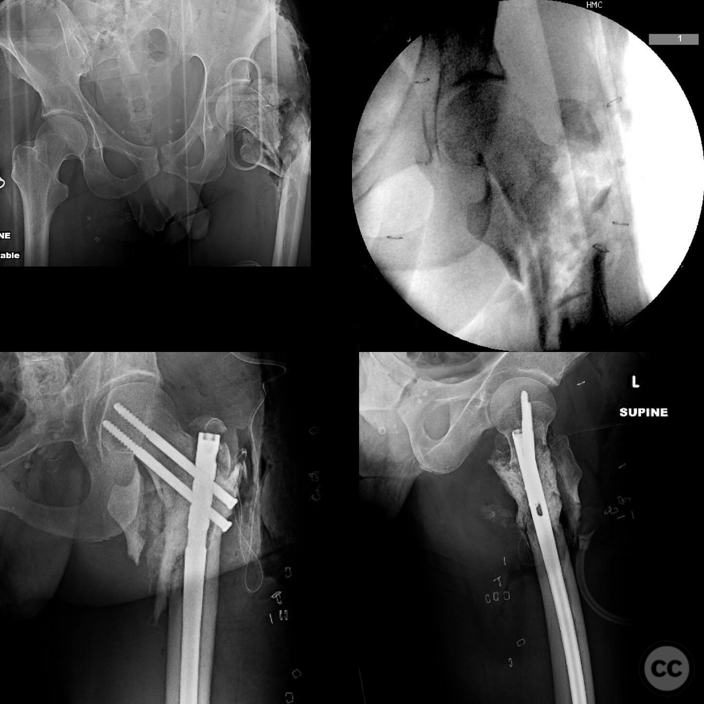 case image