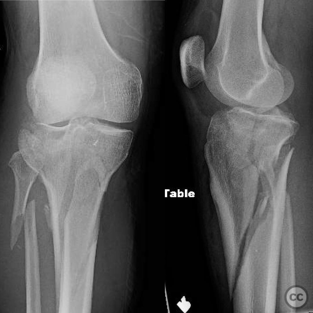 case image