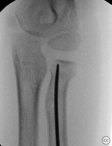 case image